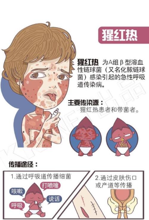 山东进入猩红热高发季节 怎样预防看这里(图)